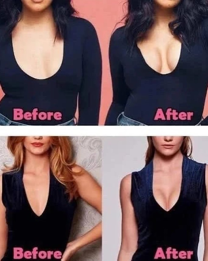 Boob Tape Chest Lift Tape